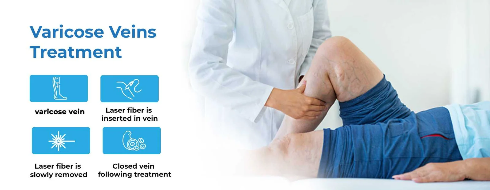 Vericose Veins